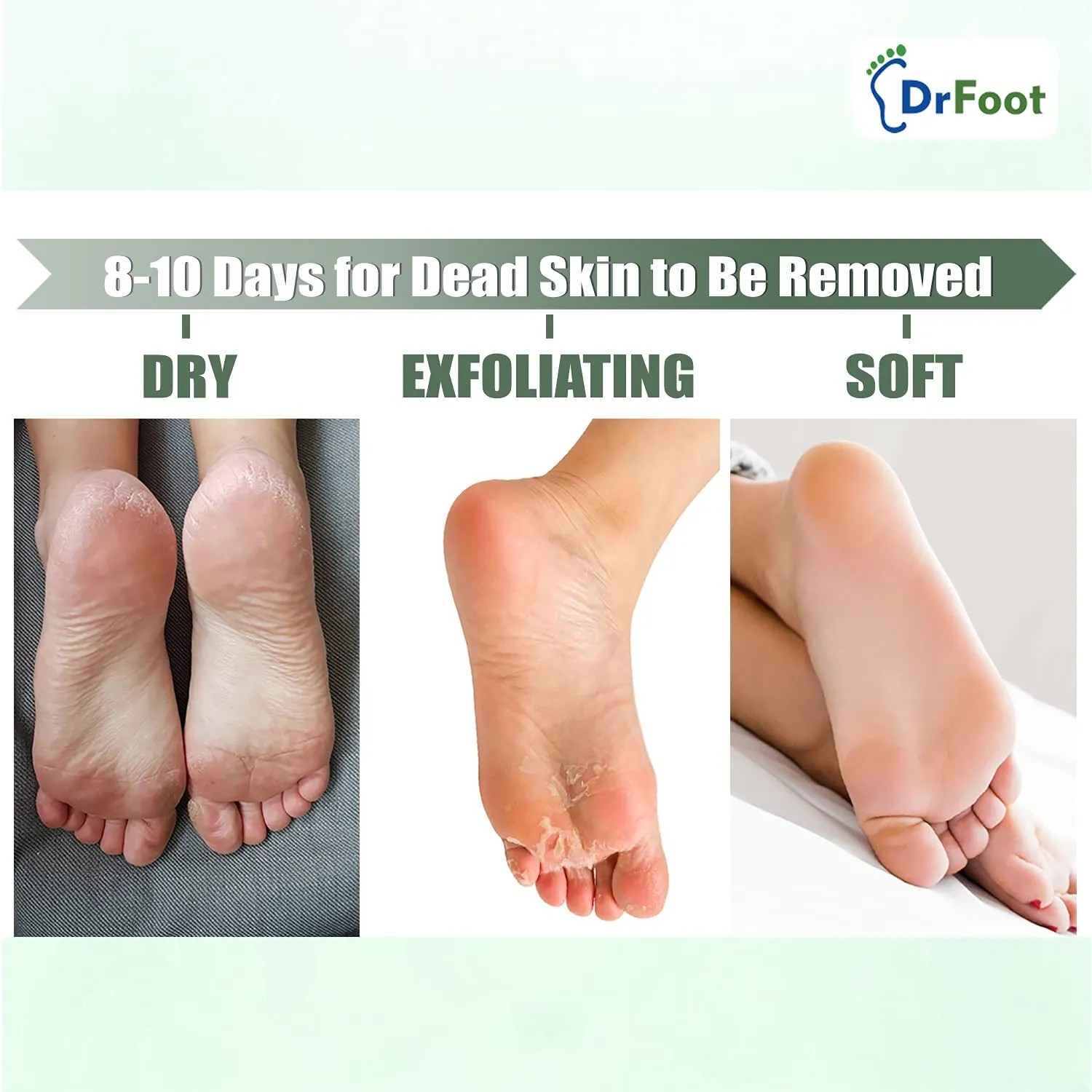 Dr Foot Exfoliating Foot Mask Sock with Urea, Lactic & Glycolic Acid and Aloe Vera - 1 Pair (Pack of 10)